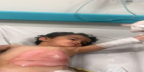 Şırnak'ta Korkutan İddia: Elektrik Kesintisi Nedeniyle Isıtılan Kaynar Su Kazanına Düşen Çocuk Yaralandı