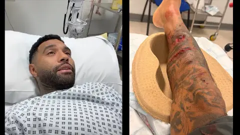 Liverpool'un eski yıldızı Jermaine Pennant'a köpek saldırdı! Bacağına 50 dikiş atıldı