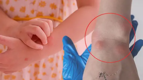 Komşuda vakalar artıyor: Can kaybı 51 oldu... Gizli tehlike Türkiye kapısında