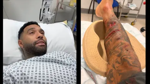 Liverpool'un eski yıldızı Jermaine Pennant'a köpek saldırdı! Bacağına 50 dikiş atıldı