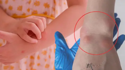 Komşuda vakalar artıyor: Can kaybı 51 oldu... Gizli tehlike Türkiye kapısında