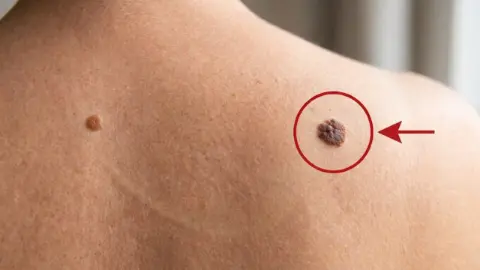 Basit bir leke deyip geçmeyin! Bu gizli sinyaller hayat kurtarıyor