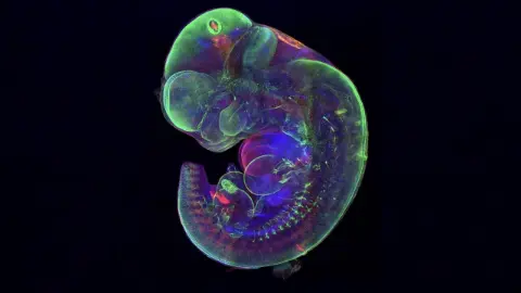 Embriyoların gelişimindeki büyük sır DNA teknolojisiyle aydınlanıyor