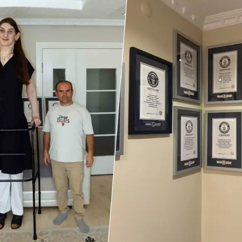 12 yılda tam 8 kez Guinness Rekorlar Kitabı’na girdi! Dünyanın en uzun kadını Rumeysa Gelgi'nin tıp dünyasını şaşırtan genetik sırrı