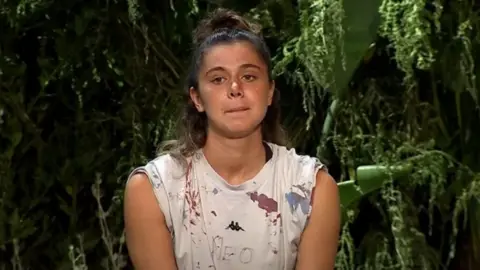 Survivor Nefise Karatay ölümden döndü: Duş kabini yüzüne patladı
