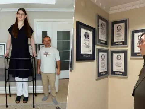 12 yılda tam 8 kez Guinness Rekorlar Kitabı’na girdi! Dünyanın en uzun kadını Rumeysa Gelgi'nin tıp dünyasını şaşırtan genetik sırrı