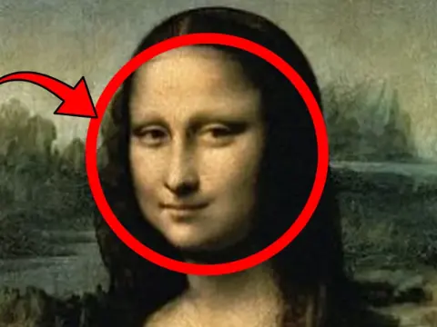 Mona Lisa'nın tablosundaki 500 yıllık sır açığa çıktı: Yüzündeki detay hastalığa işaretmiş