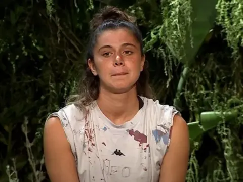 Survivor Nefise Karatay ölümden döndü: Duş kabini yüzüne patladı