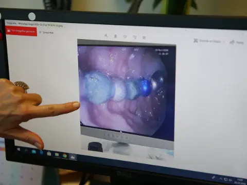 0-5 yaş arası çocuğu olanlar dikkat: Uzman doktordan hayati'oyuncak' uyarısı