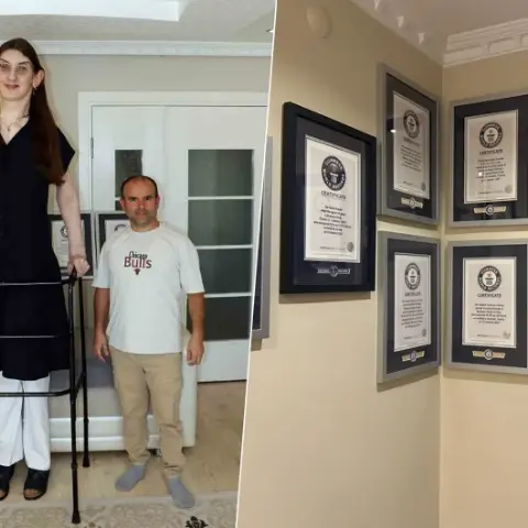 12 yılda tam 8 kez Guinness Rekorlar Kitabı’na girdi! Dünyanın en uzun kadını Rumeysa Gelgi'nin tıp dünyasını şaşırtan genetik sırrı