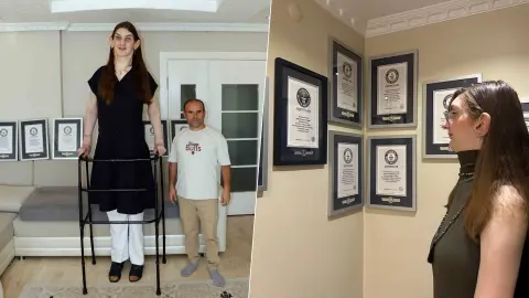 12 yılda tam 8 kez Guinness Rekorlar Kitabı’na girdi! Dünyanın en uzun kadını Rumeysa Gelgi'nin tıp dünyasını şaşırtan genetik sırrı
