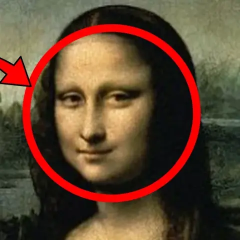 Mona Lisa'nın tablosundaki 500 yıllık sır açığa çıktı: Yüzündeki detay hastalığa işaretmiş