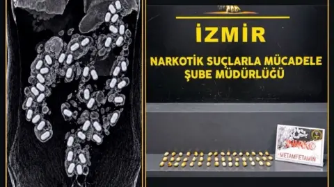 Uyuşturucuyu midesinde taşırken yakalandı