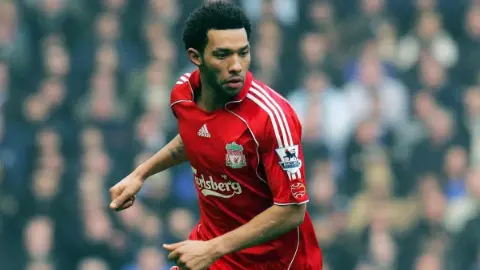 Liverpool'un eski yıldızı Jermaine Pennant'a köpek saldırdı! Bacağına 50 dikiş atıldı