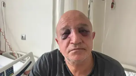 Urla'da İzmir Büfeciler Odası Başkanı'na saldırı: Hastaneye kaldırıldı