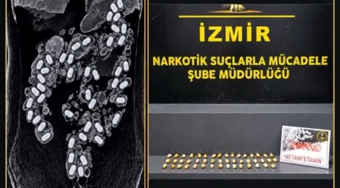 Sakarya’da Şok Operasyon! Midesinden 57 Parça Uyuşturucu Çıktı