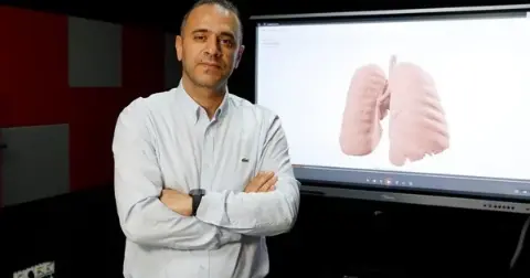 Akciğer kanseri tanısında doktorlara "ikinci göz" olacak sistem geliştiriliyor